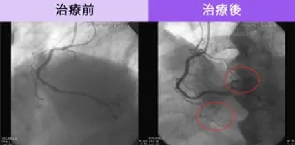 許多接受過Alma Duo野馬波治療的患者報告稱,他們在治療後的性生活質量顯著提高。