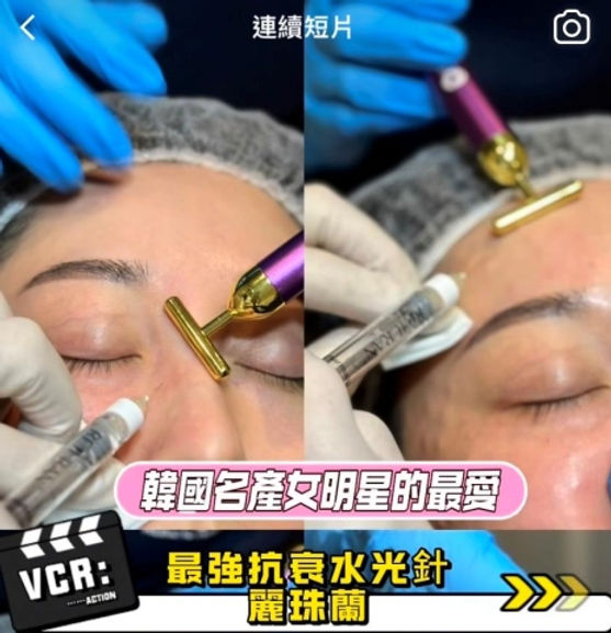 因具有極佳的肌膚修復和再生功效,由於其能夠刺激膠原蛋白增生、改善肌膚彈性、細紋和膚質,因此成為近年來醫美界的熱門選擇。