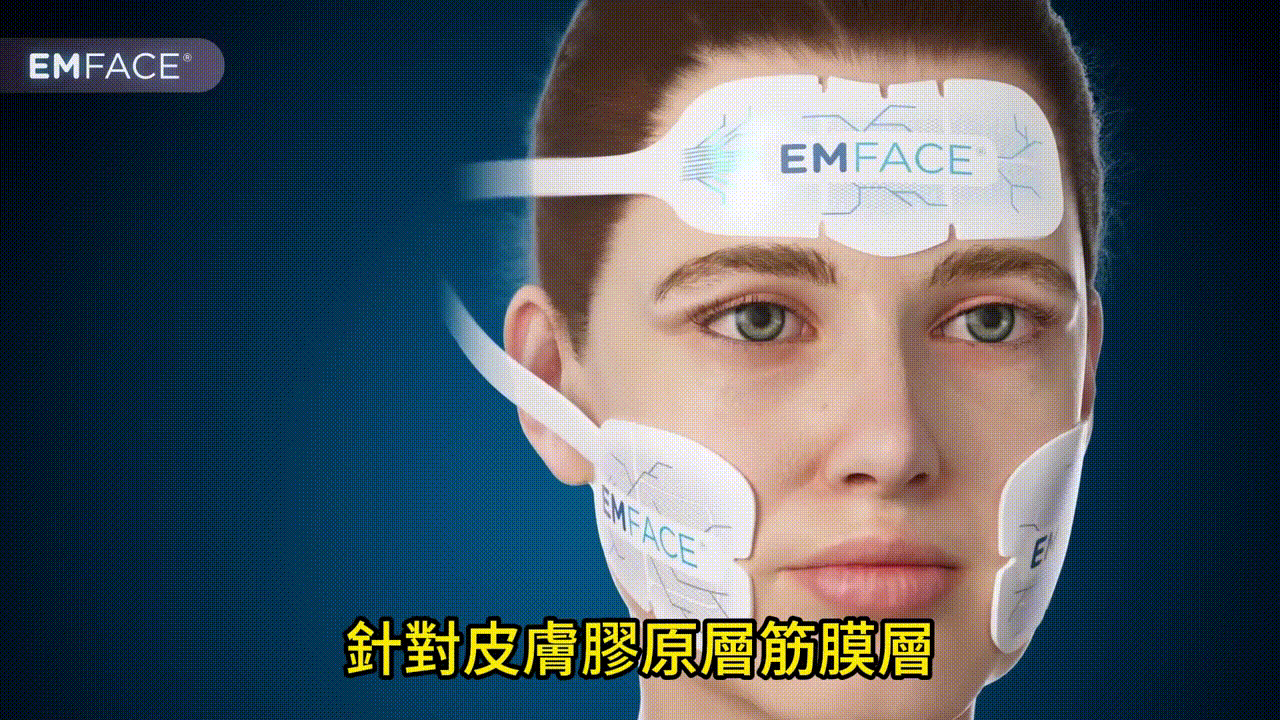 Emface菲斯波 是由國際醫美廠商 BTL 推出的 非侵入式臉部拉提 療程,其特色在於 雙重技術 結合