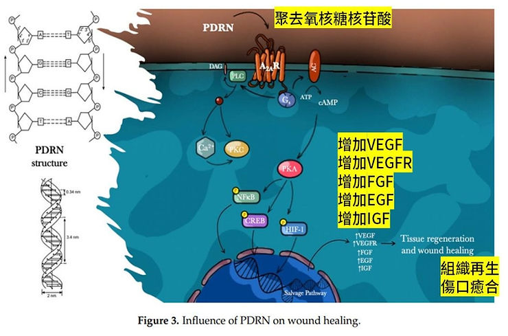PDRN(Polydeoxyribonucleotide,聚去氧核糖核苷酸)是一種來自鮭魚DNA的生物活性物質