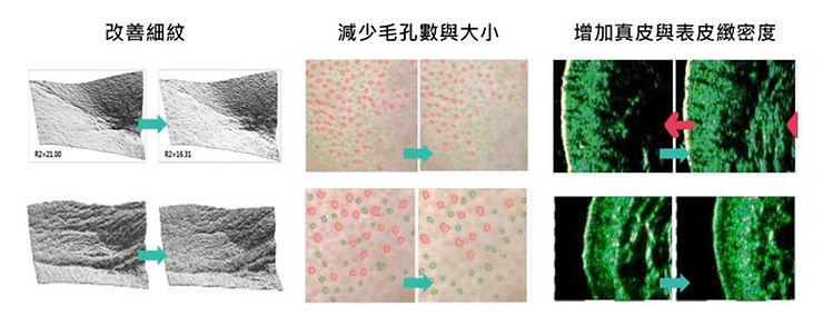 PDRN成分能有效修復受損細胞,提高肌膚自我修復能力。