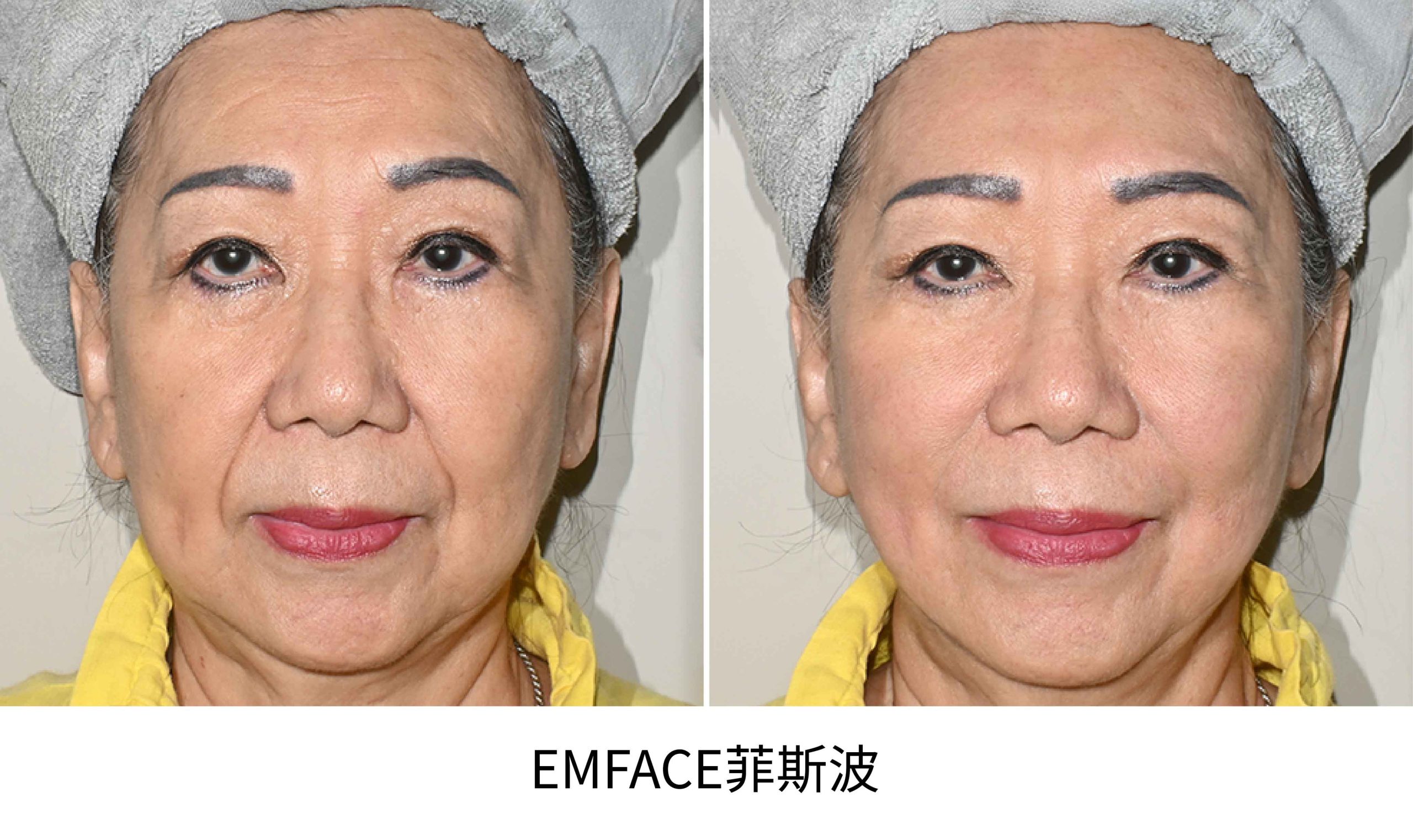 網站用圖-22